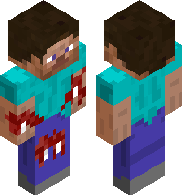 Broken limb steve