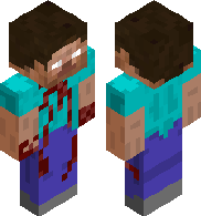 Self harm steve